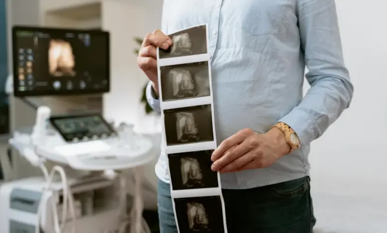 Člověk drží ultrazvukový snímek v ordinaci gynekologa