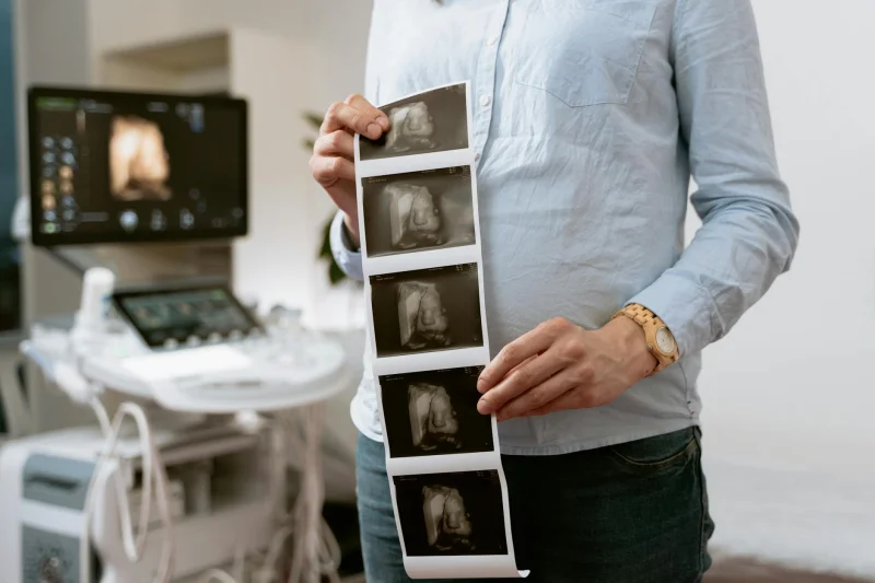 Člověk drží ultrazvukový snímek v ordinaci gynekologa