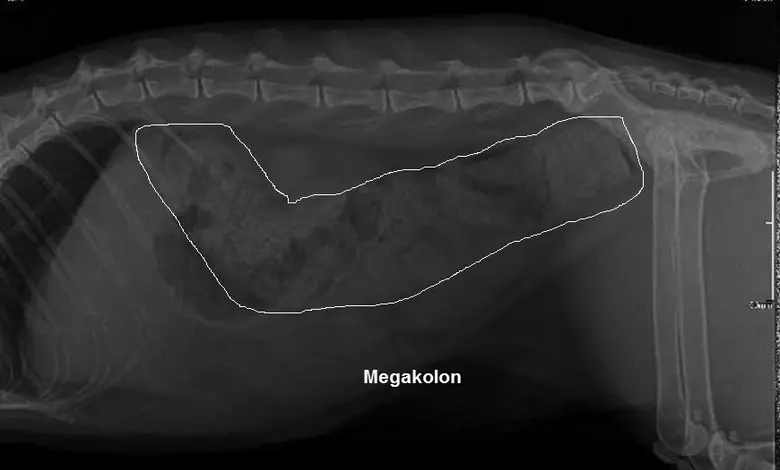 Megacolon radiograph