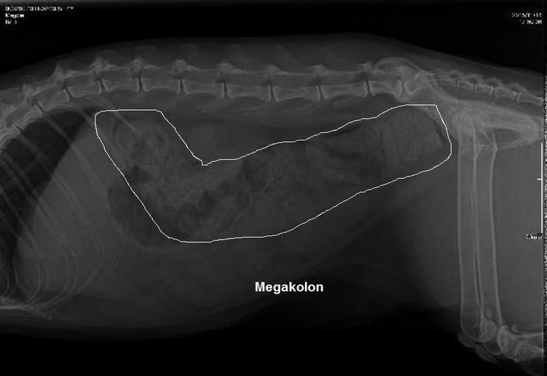 Megacolon radiograph