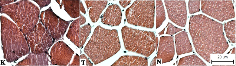 Histologický přípravek svalové tkáně pod mikroskopem