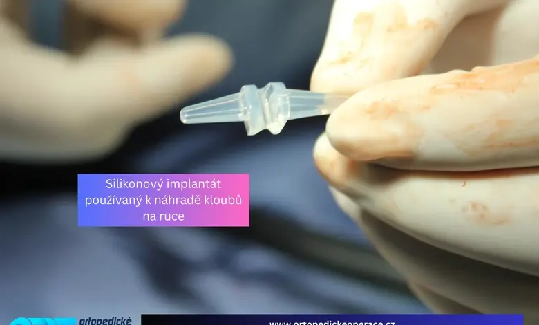Silikonový implantát pro náhradu kloubů na ruce