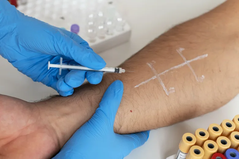 Intradermální kožní test na alergii s jehlou a rukavicemi.
